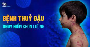 Thủy Đậu Nổi Trong Miệng